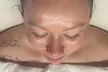 Glow Your Skin with One, Three or Five Oxygen Clarifying Facials at KP Aesthetics (Up to 73%Off) - Second Medium