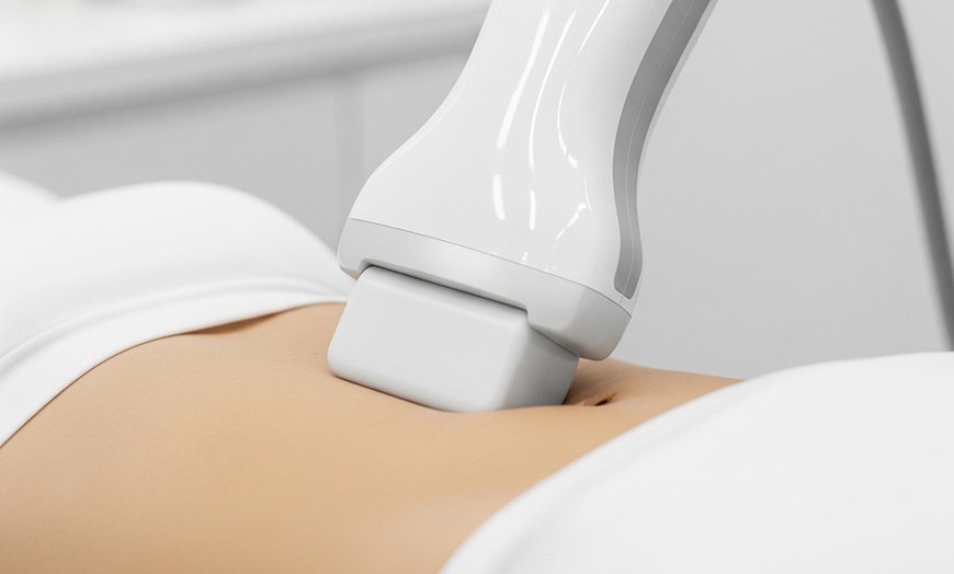 Image 2: Freeze Fat Away with Cryolipolysis for Targeted Areas
