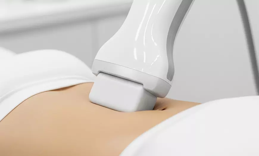 Image 2: Freeze Fat Away with Cryolipolysis for Targeted Areas