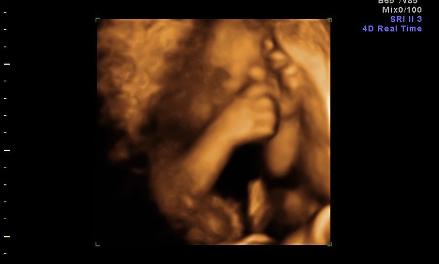 Image 3: 3D/ 4D Baby Scan