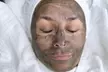 Geniet van een carbon laser peeling met zuurstof gezichtmasker bij Djenetbeauty Center In Amsterdam - Second Medium