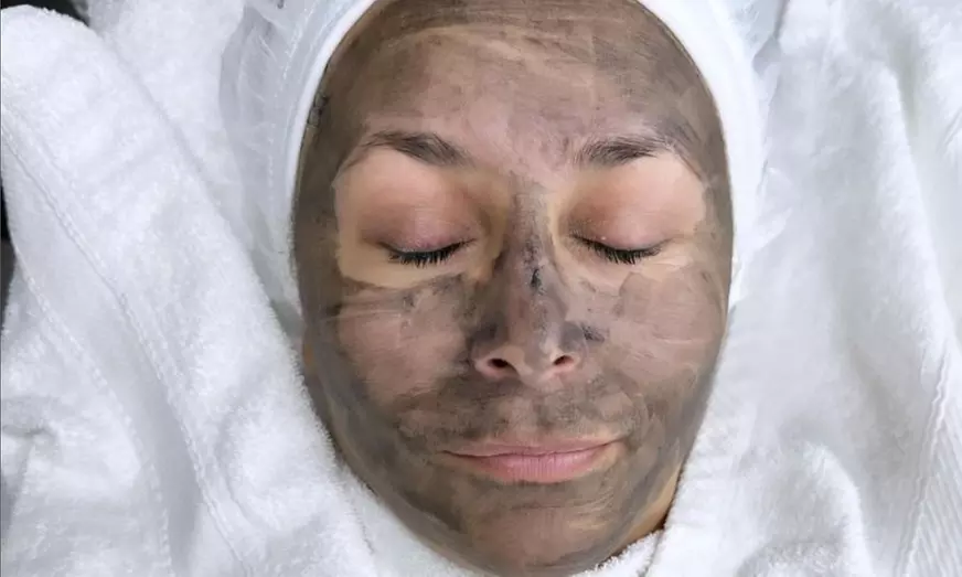 Geniet van een carbon laser peeling bij Djenetbeauty Center