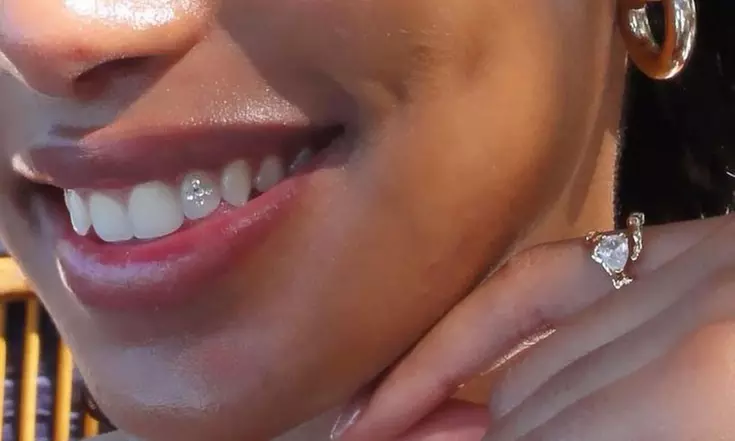 Up to 37% Off on Teeth Whitening at The Dolls Palace