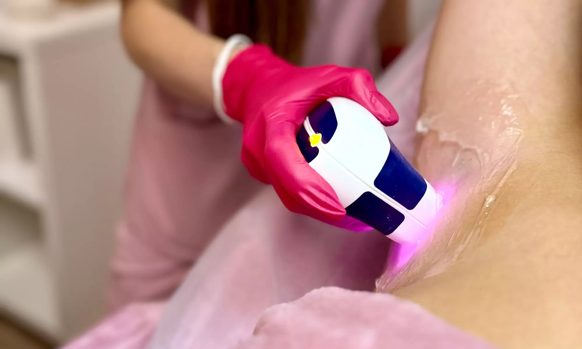 Depilacja laserowa wybranych partii lub całego ciała kobiet i mężczyzn