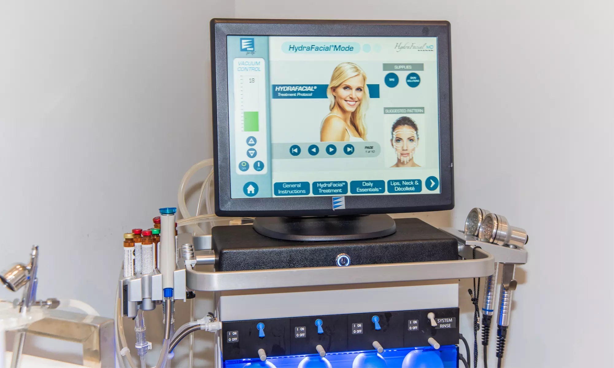 Kybella Injections for Chin Fat Reduction: One or Three Vials