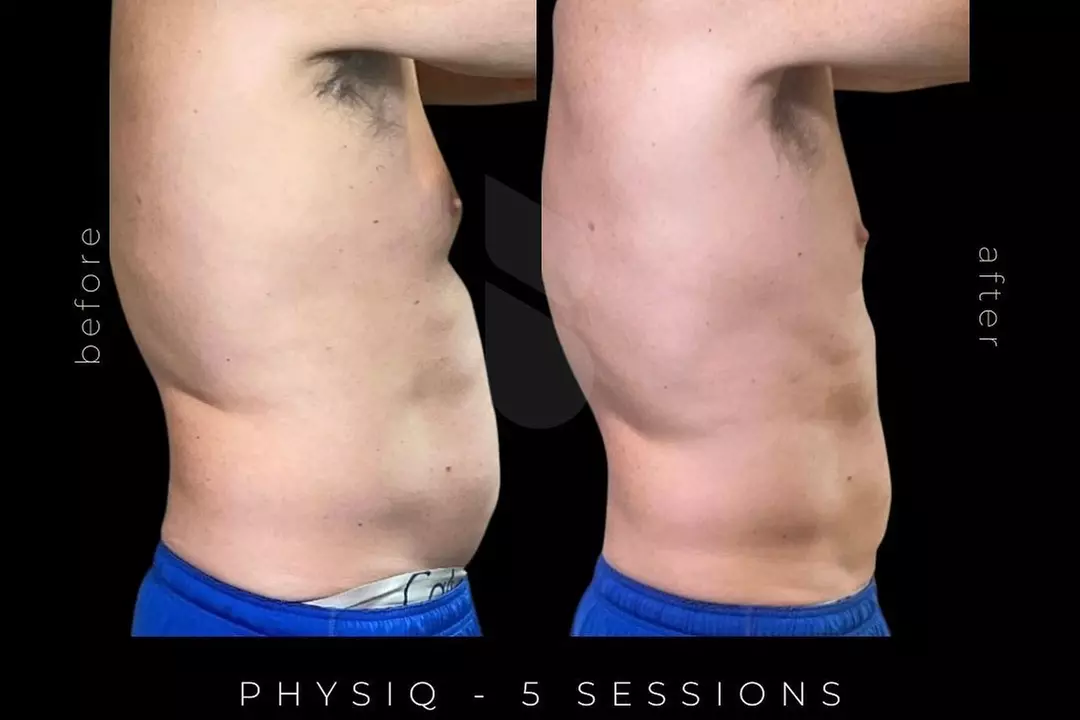 Up to 83% Off on Electrical Muscle Stimulation at The Bodie Co