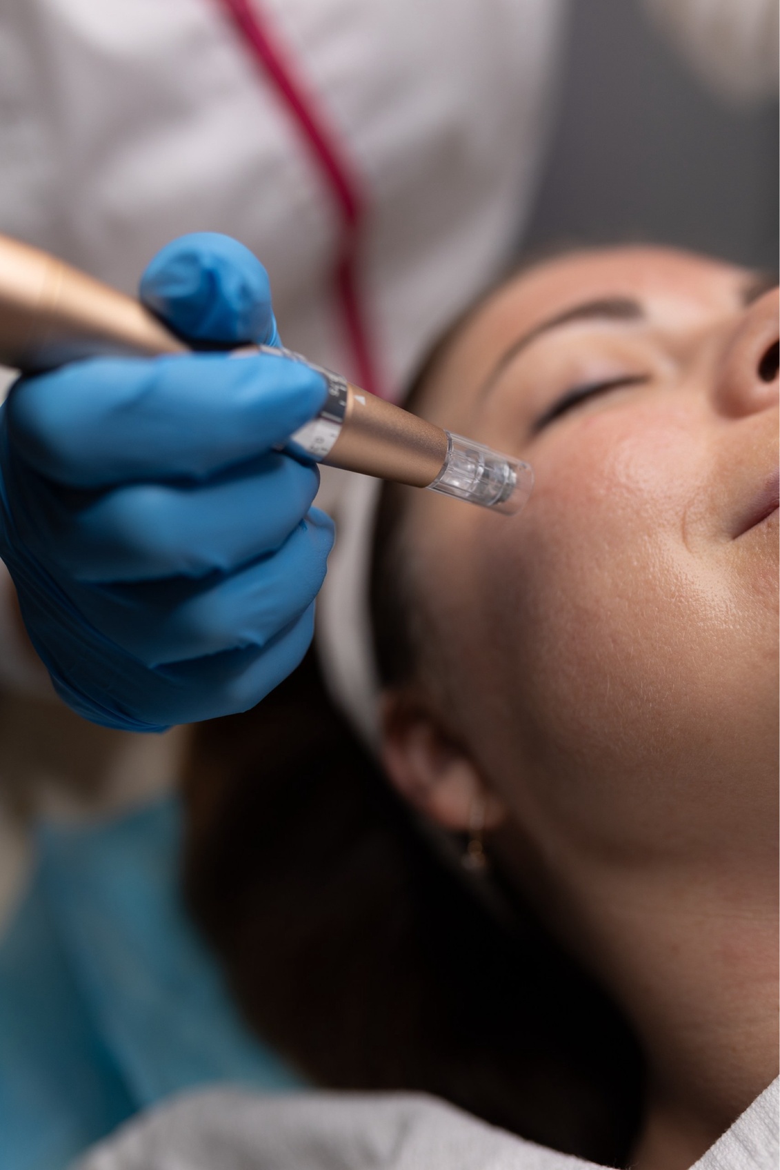 Klassische Gesichtsbehandlung, Microneedling oder Mikrodermabrasion