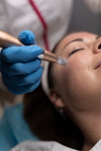 60 Min. Microneedling für 1 Person - Beauty Master Smile