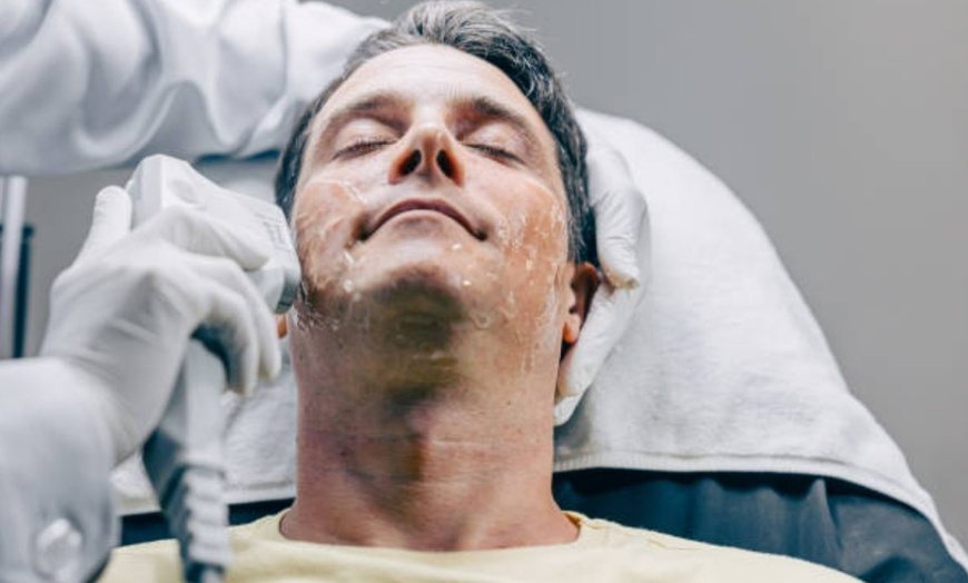 Image 9: Sesión de tratamiento HIFU facial en una zona o rostro completo