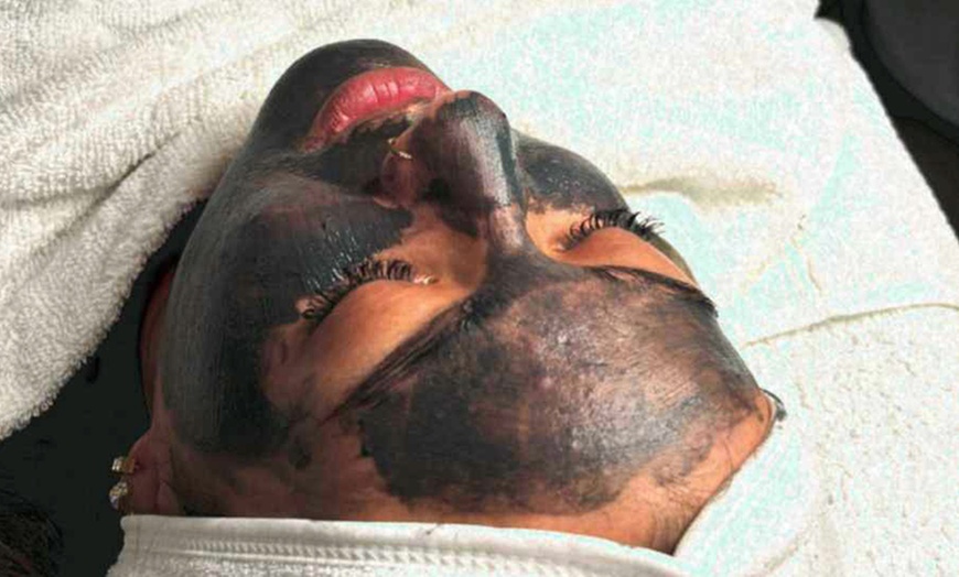 Image 2: Gesichtsbehandlung „Classic“, Hydrogen-Behandlung oder BB Glow