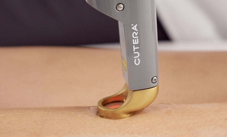 Image 2: 3 or 6 Laser Hair Removal: Small, Medium, or Large to Extra Large Area