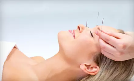 Facial Rejuvenation or Acupuncture at Blue Root Acupuncture in Lexington - Primary Image