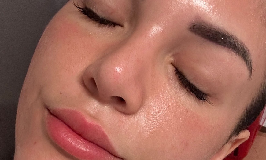 Image 2: Rabatt auf Gesichtsbehandlung – Aqua Facial bei Laser glow institut