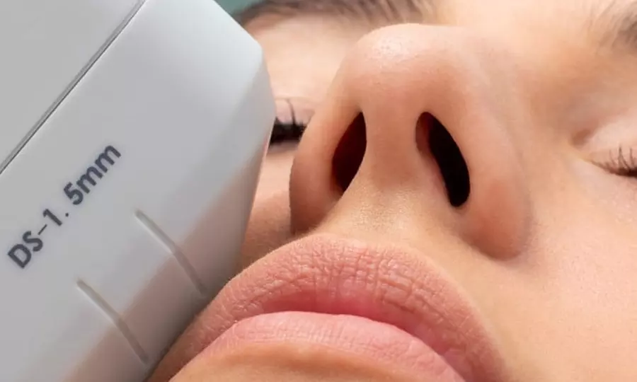 Tratamiento reafirmante HIFU