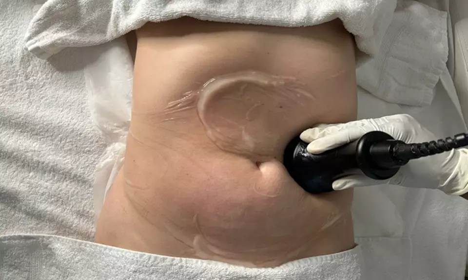 Hasta 9 sesiones de tratamiento reductor combinado para 1 persona