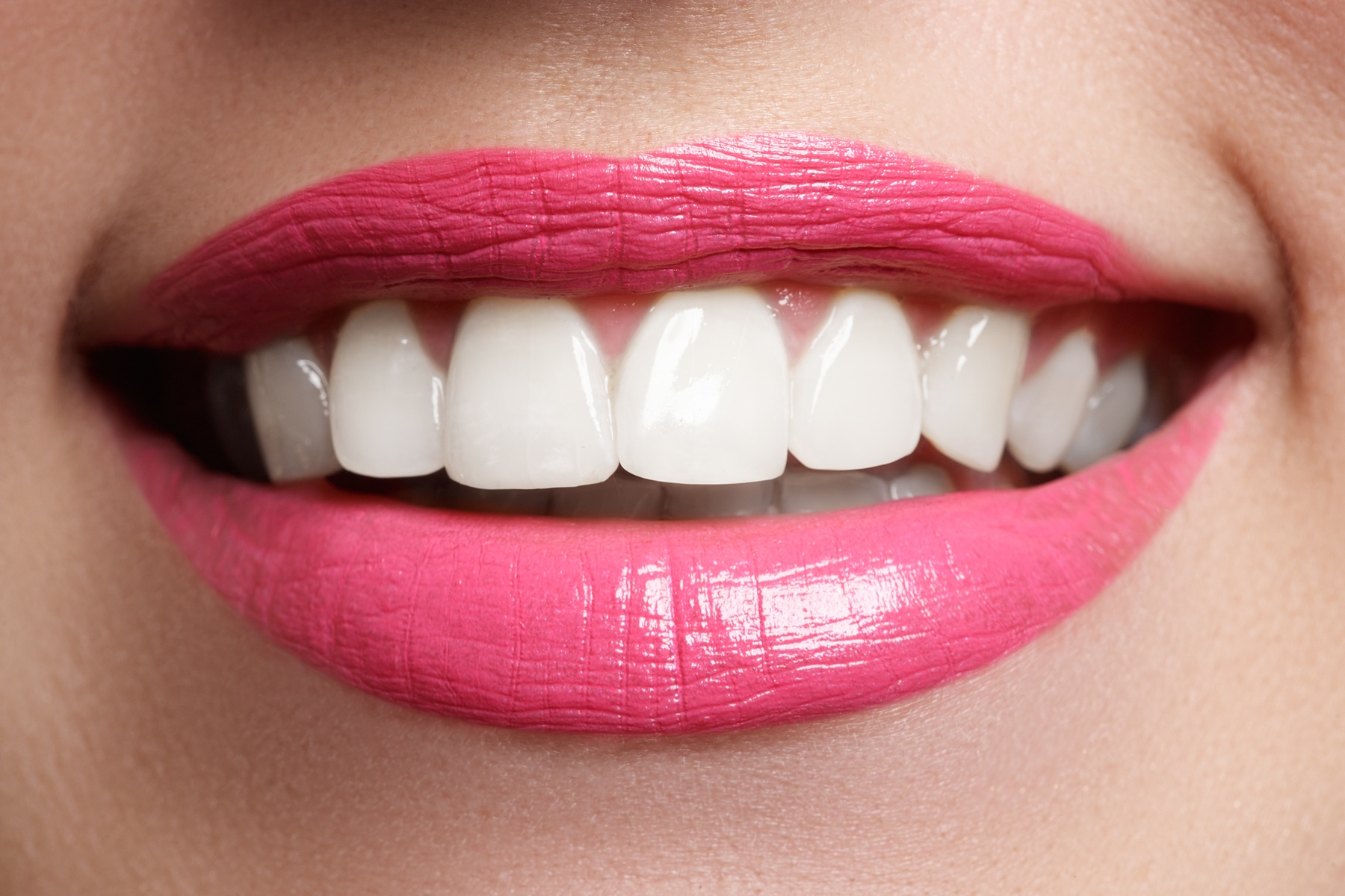 Brighten Your Smile with Laser Teeth Whitening Sessions