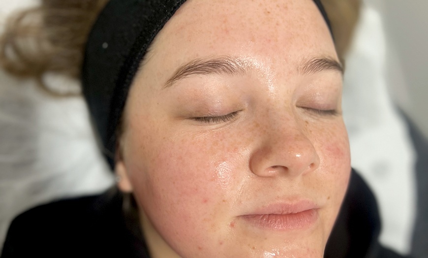 Image 2: Smooth Moves: Microdermabrasion/Classic Facial at The Skin Specialist