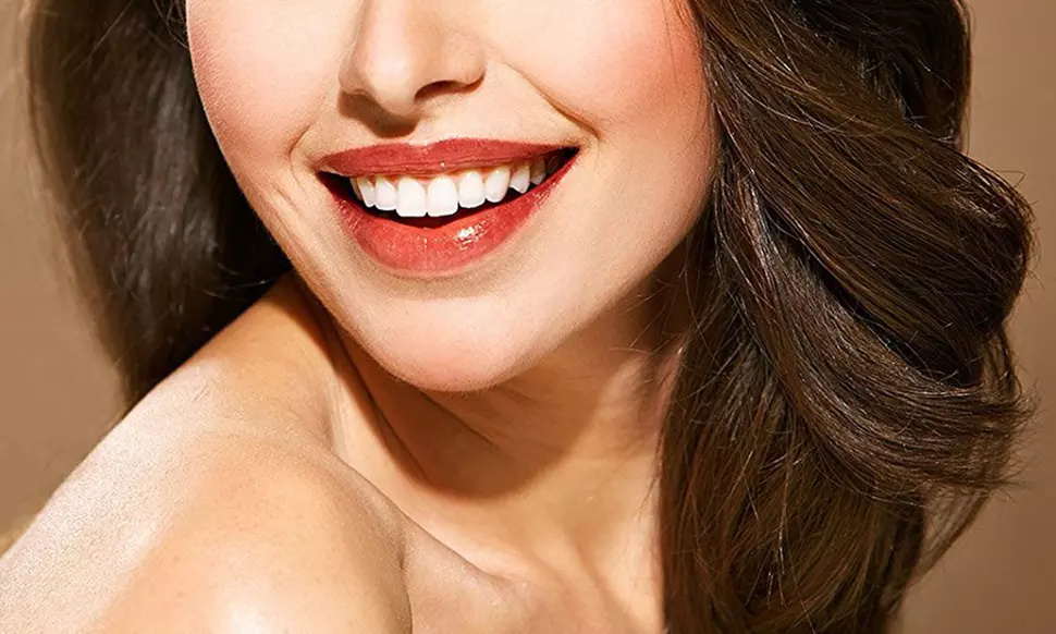 Sparkle White Teeth-Whitening Kit (7-Piece) - Second Medium