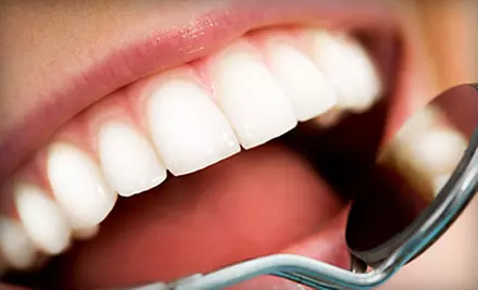Adult Checkup or Teeth Whitening at Alegre Dental - Primary Image