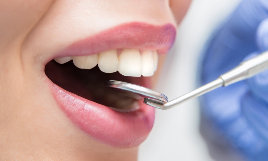 Image 2: Choice of Dental Treatment at Saphire Dent Dubai