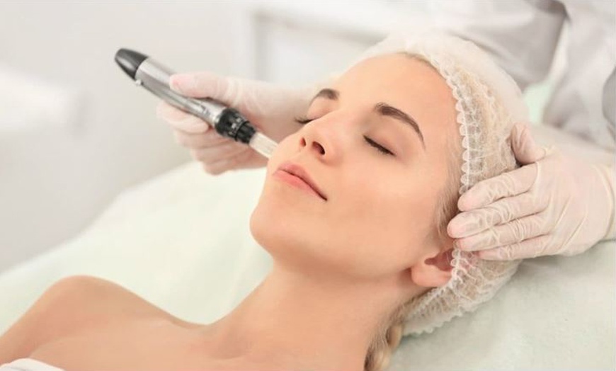 Image 1: Séance de microneedling au choix avec Glam attitude