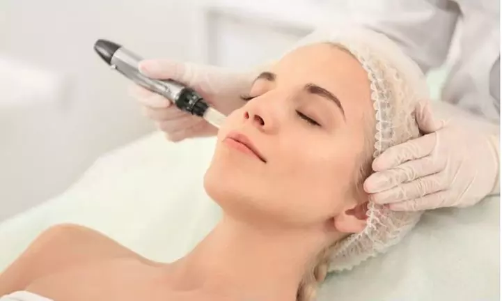 Séance de microneedling au choix avec Glam attitude
