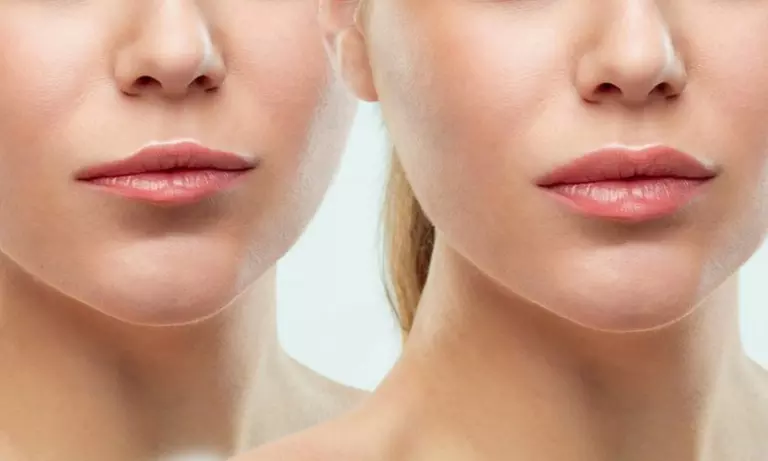 Up to 56% Off on Injection - Botox/Dysport @Tower Dental Arts
