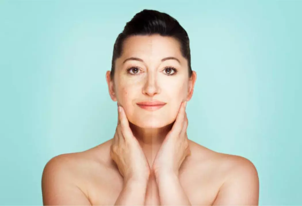 1 o 3 sesiones de láser facial para fotorrejuvenecimiento y manchas