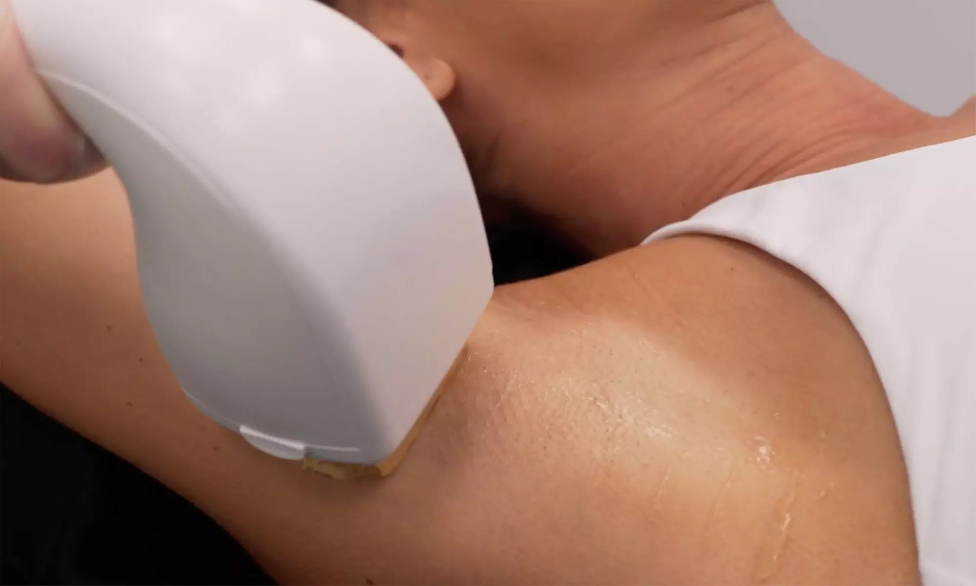 Up to 70% Off on Laser Hair Removal at BodyBrite - Lawrenceville