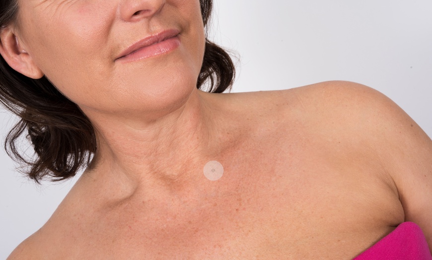 Image 6: Bioclear Skin Tag Patches