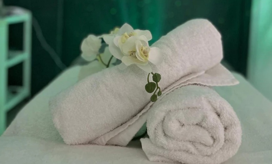 Image 2: Microneedling con vitaminas en rostro, cuello y escote para 1 persona