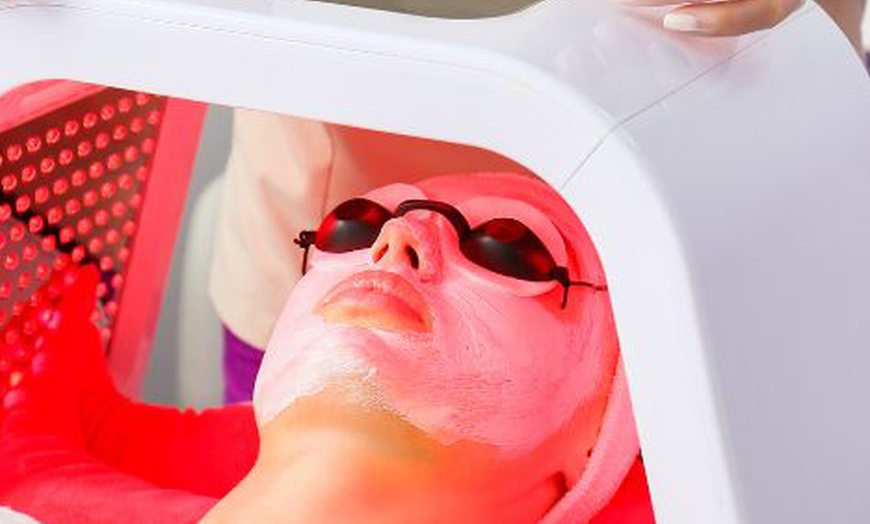 Image 3: Up to 67% Off on Facial - HydraFacial at Skinologic Clinic London