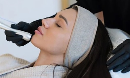 1 sesión de dermapen facial con cóctel de vitaminas - Clínica G. Gónzález