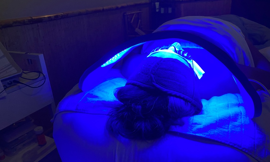 Image 4: Two 15- or 30-Minute Electrolysis Permanent Hair-Removal Treatments