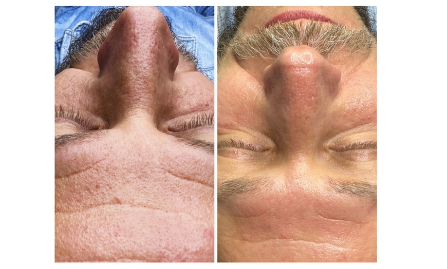 Image 4: Hydra Glow Hollywood Skin Care - Deluxe or Classic, or Mini Facial