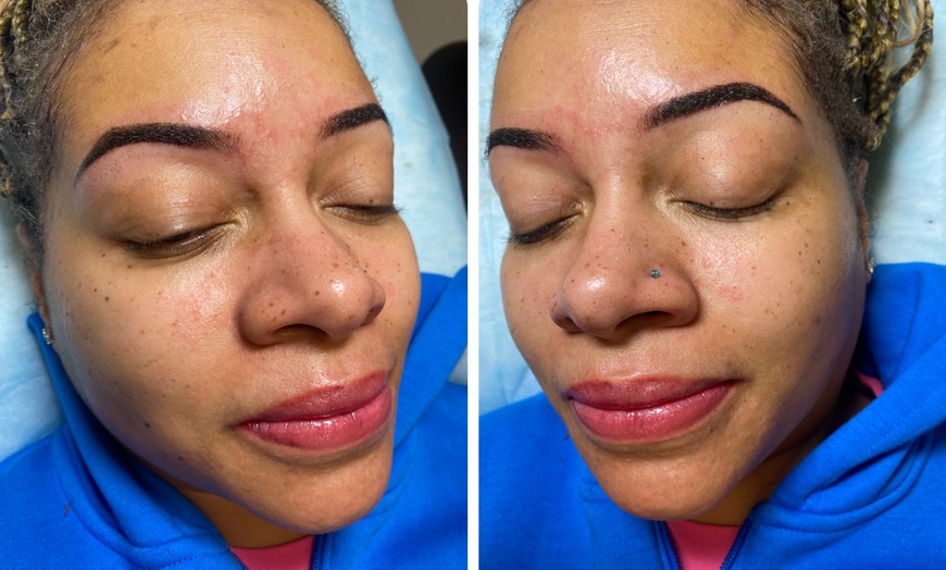 Image 6: Enhance Your Look With Microblading, Lip Blush or Eyeliner Tattoo 