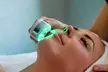 Limpieza facial con microdermoabrasión, peeling ultrasónico, crioterapia y más para 1 persona, ahorra hasta un 50% - Second Medium