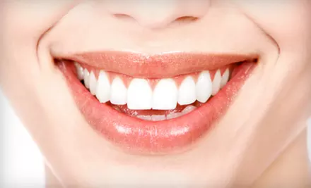 Teeth Whitening or Dental Care Package with Cleaning, X-Rays, and Exam at Acierno Dental (Up to 85% Off) - Primary Image