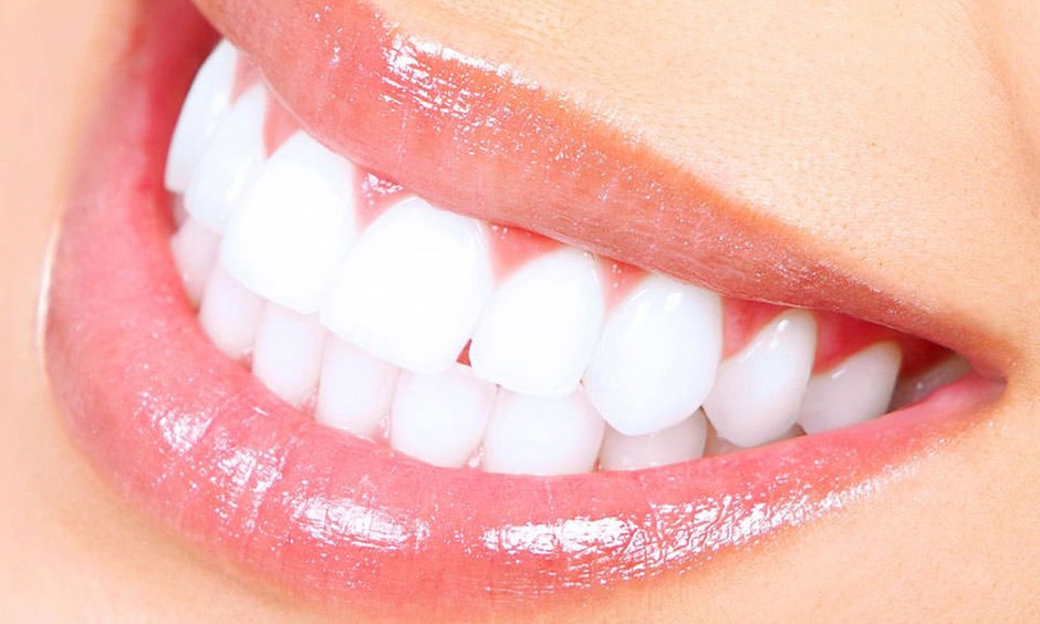 Hasta 35% de descuento en Examen dental (limpieza, radiografías, revisión) en Sintas Dental