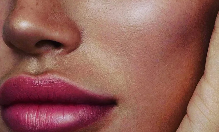 Image 1: Achieve Youthful Lips or Cheeks with Dermal Filler Injections!