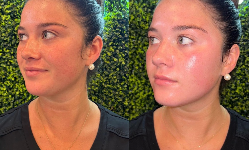 Image 3: Unlimited Laser Hair Removal Sessions for Multiple Areas