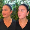 Image 3: Unlimited Laser Hair Removal Sessions for Multiple Areas
