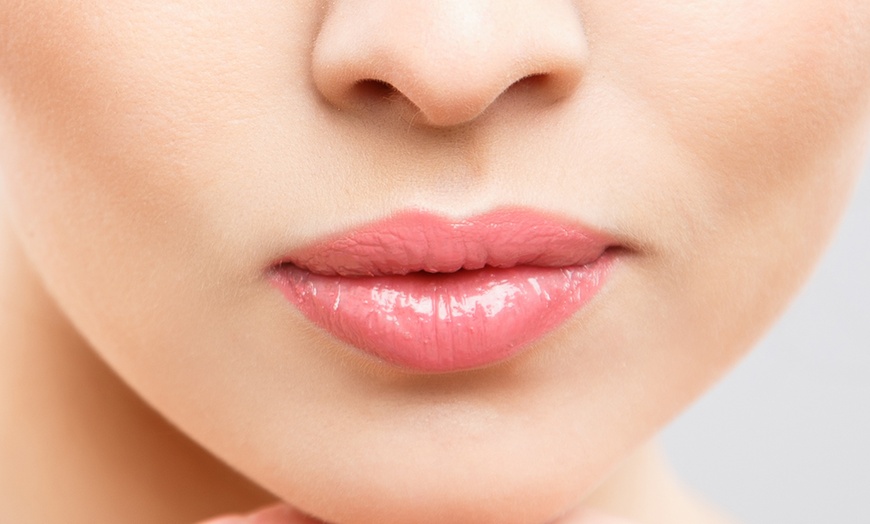 Image 1: Skin Boosters - Seventy Hyal - Hyaluronic Acid or 1 ml Lip Filler