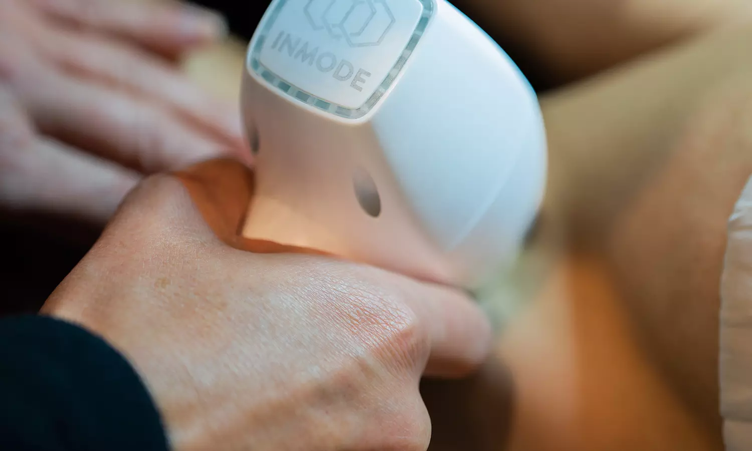 Experience Smooth Skin with Laser Hair Removal Sessions