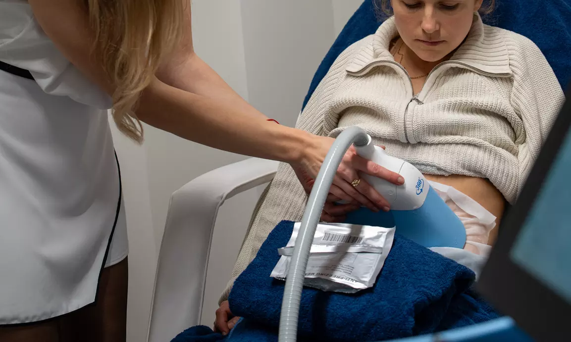 1, 2 oder 3 Kryolipolyse-Behandlungen an einer Zone für 1 Person