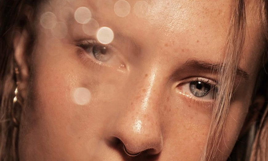 Image 14: 1, 2 o 3 sesiones de microneedling facial de vitaminas con Dermapen