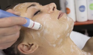 Hydrodermabrasion