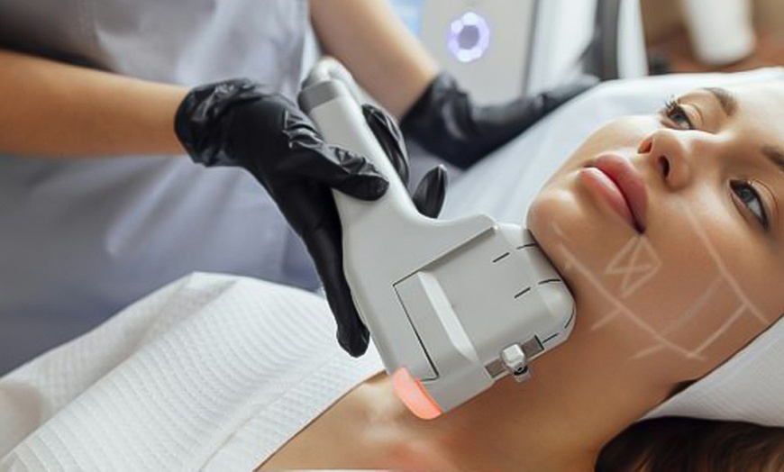 Image 3: Lift & Tighten: HIFU Neck, Half Face, Full Face, Neck, or Body