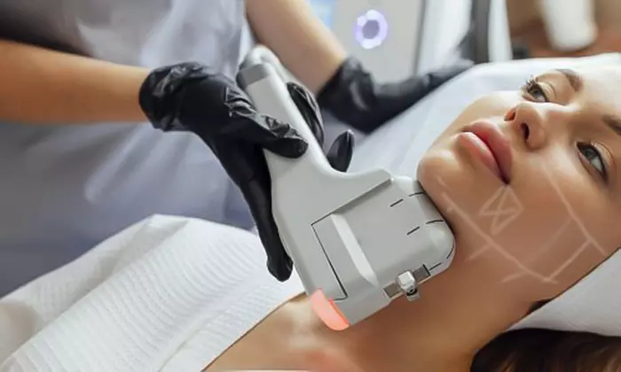 Lift & Tighten: HIFU Neck, Half Face, Full Face, Neck, or Body