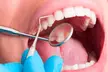 Limpieza bucal y una o dos sesiones de blanqueamiento dental LED en Loida María Carrasco Díaz hasta un 87% menos - Second Medium